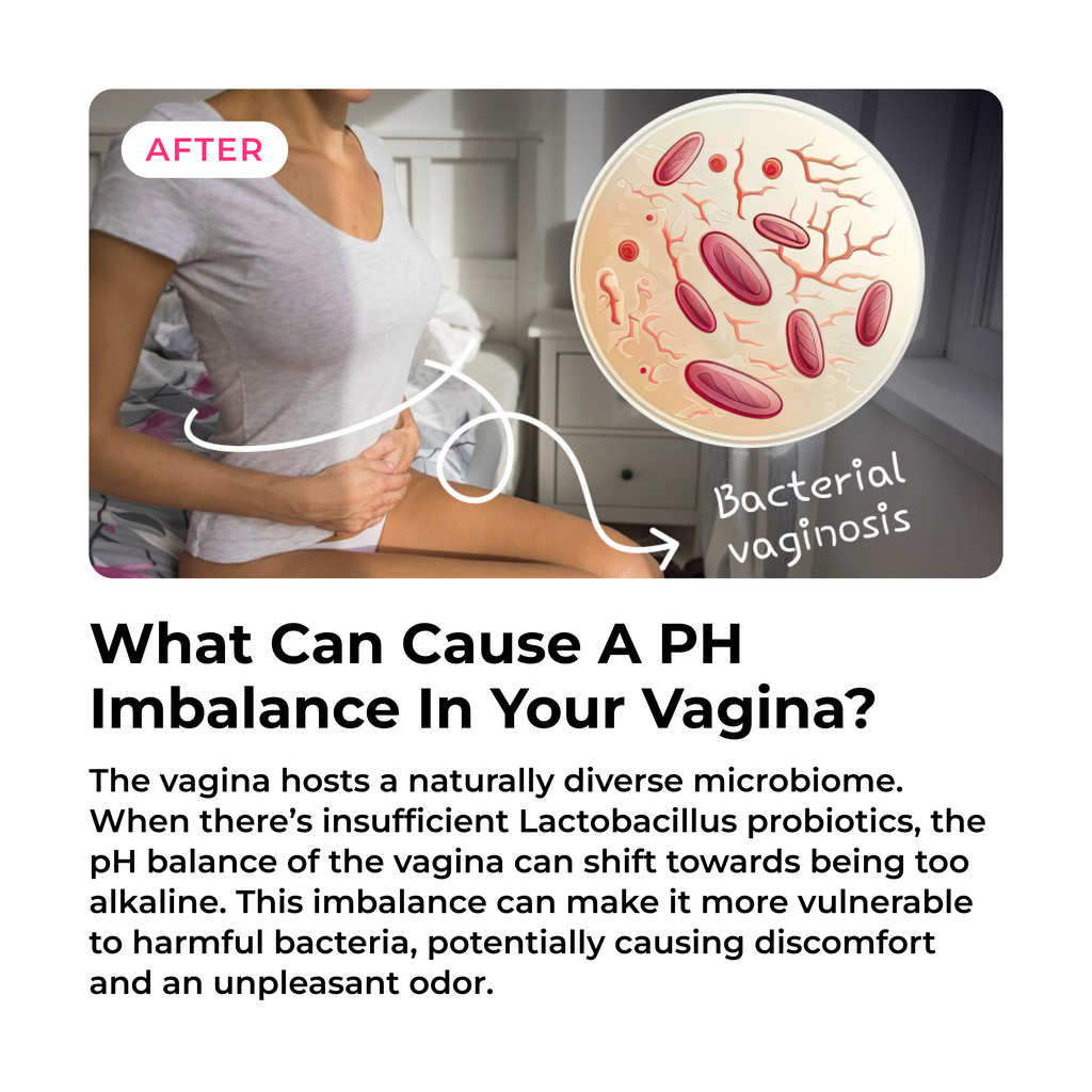 FEMENINE FLORA SUPPORT CAPSULES