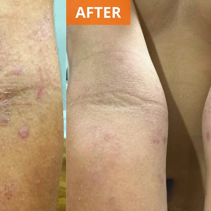Moisturizing Skin Cream